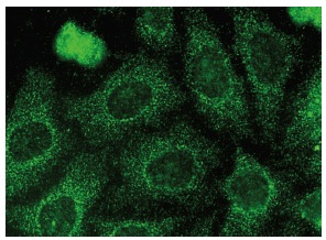  Alix (C-11): sc-271975. Immunofluorescence staining of methanol-fixed HeLa cells showing cytoplasmic localization.