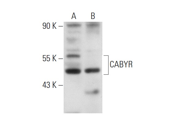  CABYR (K-16): sc-84766. Western blot analysis of CABYR expression in ES-2 (A) and PC-3 (B) whole cell lysates.