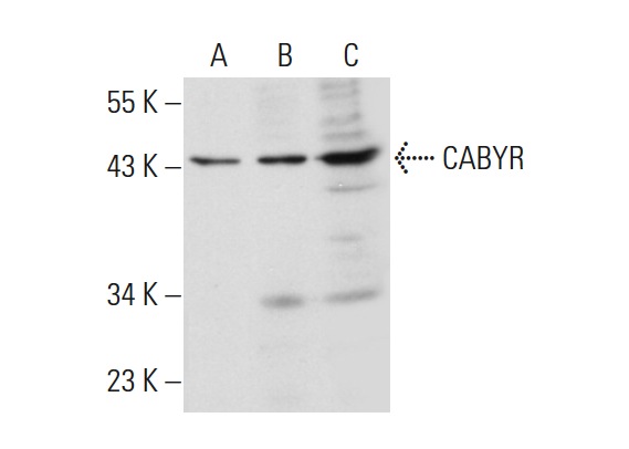  CABYR (K-16): sc-84766. Western blot analysis of CABYR expression in NTERA-2 cl.D1 (A), HeLa (B) and A549 (C) whole cell lysates.