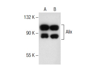  Alix (G-10): sc-166952. Western blot analysis of Alix expression in Jurkat (A) and HeLa (B) whole cell lysates.