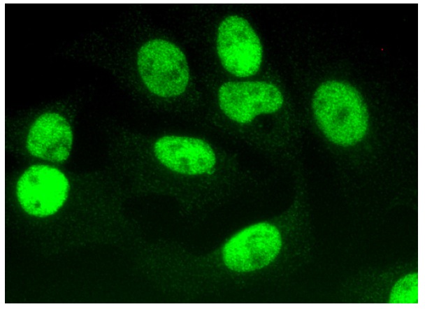  CAS (H-2): sc-271537. Immunofluorescence staining of formalin-fixed HepG2 cells showing nuclear localization.