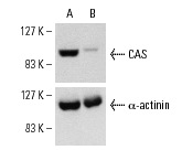  CAS siRNA (h): sc-29908. Western blot analysis of CAS expression in non-transfected control (A) and CAS siRNA transfected (B) HeLa cells. Blot probed with CAS (C-20): sc-1708. α-actinin (H-2): sc-17829 used as specificity and loading control.