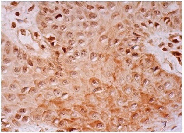  CAS (H-300): sc-28233. Immunoperoxidase staining of formalin fixed, paraffin-embedded oral mucosa tissue showing nuclear and cytoplasmic staining of glandular cells.