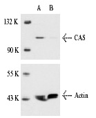  CAS siRNA (m): sc-29909. Western blot analysis of CAS expression in non-transfected control (A) and CAS siRNA transfected (B) NIH/3T3 cells. Blot probed with CAS (N-19): sc-1709. Actin (I-19): sc-1616 used as specificity and loading control.