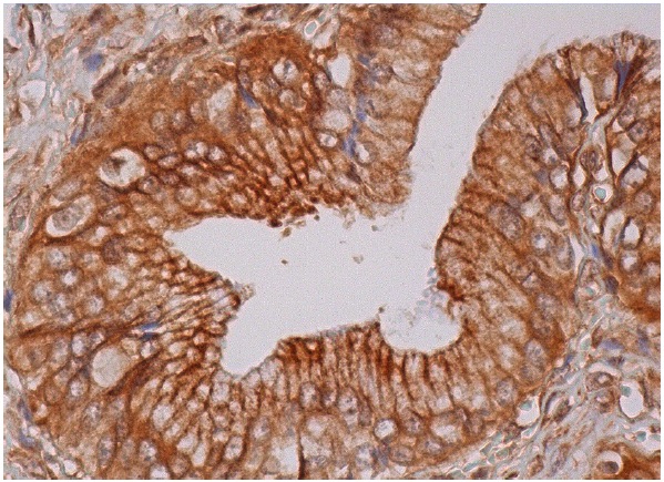  Alix (H-270): sc-99010. Immunoperoxidase staining of formalin fixed, paraffin-embedded human gall bladder tissue showing cytoplasmic and membrane staining of glandular cells.