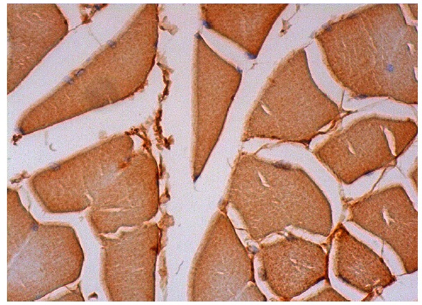  CASC1 (A-14): sc-136596. Immunoperoxidase staining of formalin fixed, paraffin-embedded human skeletal muscle tissue showing cytoplasmic staining of myocytes.