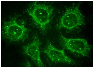  Alix (N-20): sc-49267. Immunofluorescence staining of methanol-fixed HeLa cells showing cytoplasmic localization.