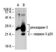  caspase-3 (H-277): sc-7148. Western blot analysis of caspase-3 expression in non-transfected: sc-117752 (A) and human caspase-3 transfected: sc-113427 (B) 293T whole cell lysates.