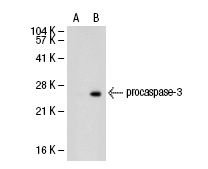  caspase-3 (L-18): sc-1225. Western blot analysis of caspase-3 expression in non-transfected: sc-117752 (A) and human caspase-3 transfected: sc-113427 (B) 293T whole cell lysates.