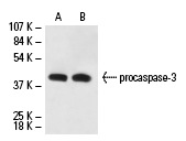  caspase-3 (CPP324-1-18): sc-56052. Western blot analysis of caspase-3 expression in non-transfected: sc-117752 (A) and human caspase-3 transfected: sc-113427 (B) 293T whole cell lysates.