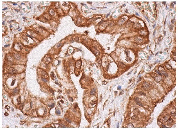  Alix (Q-19): sc-49268. Immunoperoxidase staining of formalin fixed, paraffin-embedded human gall bladder tissue showing cytoplasmic and membrane staining of glandular cells.