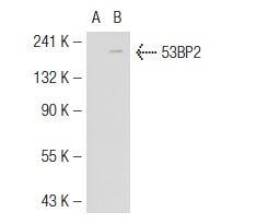  53BP2 (DX54.10): sc-53861. Western blot analysis of 53BP2 expression in non-transfected: sc-117752 (A) and mouse 53BP2 transfected: sc-118036 (B) 293T whole cell lysates.