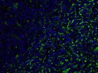  Immunofluorescent analysis of ( 4% PFA) fixed human tonsillitis tissue using YF488-60330 (Vimentin antibody) at dilution of 1:100.