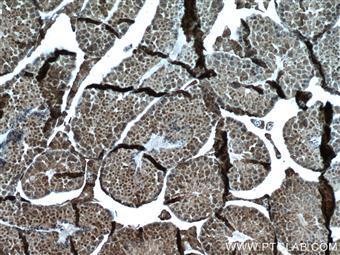  Immunohistochemistry of paraffin-embedded mouse testis tissue slide using 66585-1-Ig (WBP2 antibody) at dilution of 1:500 (under 10x lens) heat mediated antigen retrieved with Tris-EDTA buffer(pH9).