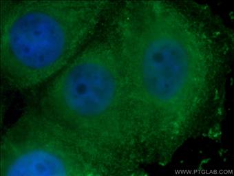  Immunofluorescent analysis of ( -20°C Ethanol) fixed MCF-7 cells using 66656-1-Ig (WNT2 antibody) at dilution of 1:100 and Alexa Fluor 488-Conjugated AffiniPure Goat Anti-Rabbit IgG(H+L)