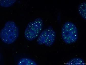  Immunofluorescent analysis of ( -20°C Ethanol) fixed HepG2 cells using 66652-1-Ig (XRCC2 antibody) at dilution of 1:100 and Alexa Fluor 488-Conjugated AffiniPure Goat Anti-Mouse IgG(H+L)