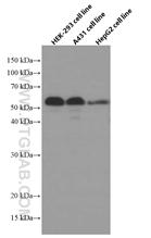  Various lysates were subjected to SDS PAGE followed by western blot with 66621-1-Ig (XRCC4 antibody) at dilution of 1:3000 incubated at room temperature for 1.5 hours