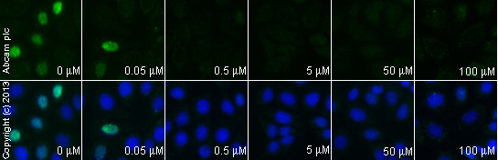  ab40754 staining cyclin D1 in MCF7 cells treated with KN-93 (water soluble) (ab120980), by ICC/IF. Decrease in cyclin D1 expression correlates with increased concentration of KN-93 (water soluble), as described in literature.The cells were incubated at 37°C for 24 hours in media containing different concentrations of ab120980 (KN-93 (water soluble)) in DMSO, fixed with 100% methanol for 5 minutes at -20°C and blocked with PBS containing 10% goat serum, 0.3 M glycine, 1% BSA and 0.1% tween for 2h at room temperature. Staining of the treated cells with ab40754 (1/100 dilution) was performed overnight at 4°C in PBS containing 1% BSA and 0.1% tween. A DyLight 488 goat anti-rabbit polyclonal antibody (ab96899) at 1/250 dilution was used as the secondary antibody. Nuclei were counterstained with DAPI and are shown in blue.