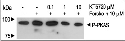  KT5720 inhibits PKAS phosphorylation via PKA. NIH/C6 cells were preincubated for 45 min with different concentrations of KT5720 (ab141818) and then stimulated with 10 µM Forskolin (ab120058) for 20 min. Cell proteins were resolved by SDS-PAGE and probed with antiphospho-(Ser/Thr) PKAS (PKA substrate).