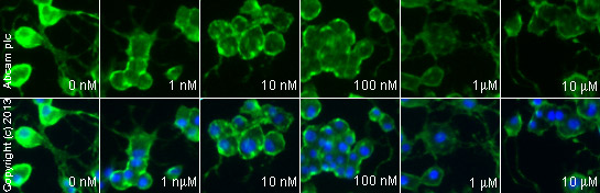  ab113202 staining NET1 in PC-12 cells treated with milnacipran hydrochloride (ab120755), by ICC/IF. Decrease of NET1 expression correlates with increased concentration of milnacipran hydrochloride, as described in literature.The NGF treated cells were incubated at 37°C for 6 hour in media containing different concentrations of ab120755 (milnacipran hydrochloride ) in DMSO, fixed with 4% formaldehyde for 10 minutes at room temperature and blocked with PBS containing 10% goat serum, 0.3 M glycine, 1% BSA and 0.1% tween for 2h at room temperature. Staining of the treated cells with ab113202 (5 µg/ml) was performed overnight at 4°C in PBS containing 1% BSA and 0.1% tween. A DyLight 488 anti-rabbit polyclonal antibody (ab96899) at 1/250 dilution was used as the secondary antibody. Nuclei were counterstained with DAPI and are shown in blue.