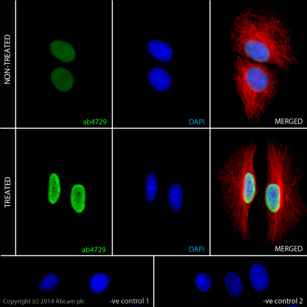  ab4729 staining Histone H3 (acetyl K27) in HeLa cells. The cells were incubated with 10mM Sodium butyrate (ab120948) for 6 hours (Treated) or solvent-only for control purposes (Non-treated). Cells were fixed with 100% methanol (5min) and then blocked in 1% BSA/10% normal goat serum/0.3M glycine in 0.1%PBS-Tween for 1h. The cells were then incubated with ab4729 at 0.5µg/ml and ab7291 at 1µg/ml overnight at +4°C, followed by a further incubation at room temperature for 1h with a anti-rabbit AlexaFluor®488 secondary antibody (ab150077) at 2 µg/ml (shown in green) and a goat anti-mouse AlexaFluor®594 (ab150120) at 2 µg/ml (shown in pseudo colour red). Nuclear DNA was labelled in blue with DAPI. Negative controls: 1– Rabbit primary and anti-mouse secondary antibody; 2 – Mouse primary antibody and anti-rabbit secondary antibody. Controls 1 and 2 indicate that there is no unspecific reaction between primary and secondary antibodies used. 