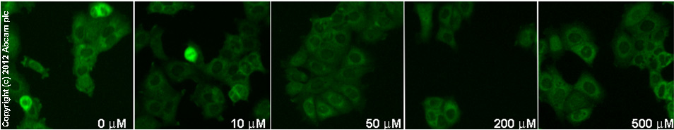  ab47489 staining Bcl2 MCF7 cells treated with diadzein (ab120391), by ICC/IF. Decrease in Bcl2 expression correlates with increased concentration of diadzein, as described in literature.The cells were incubated at 37°C for 6h in media containing different concentrations of ab120391 (diadzein) in DMSO, fixed with 4% formaldehyde for 10 minutes at room temperature and blocked with PBS containing 10% goat serum, 0.3 M glycine, 1% BSA and 0.1% tween for 2h at room temperature. Staining of the treated cells with ab47489 (5 µg/ml) was performed overnight at 4°C in PBS containing 1% BSA and 0.1% tween. A DyLight 488 goat anti-rabbit polyclonal antibody (ab96899) at 1/250 dilution was used as the secondary antibody.